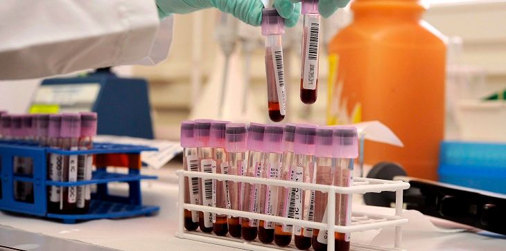 Президент ОКР заявил, что Россия будет активно участвовать в реформе WADA