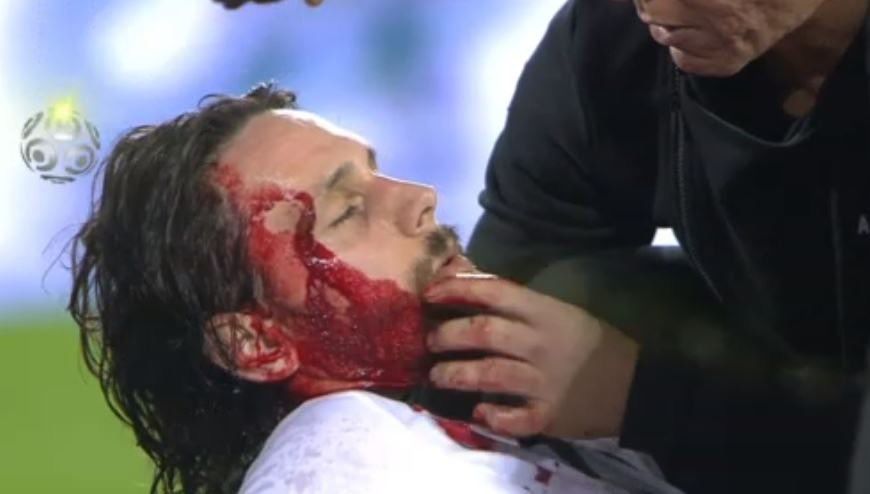 Суботича увезли в больницу прямо с матча. Ему попали коленом в висок, выглядит жутко