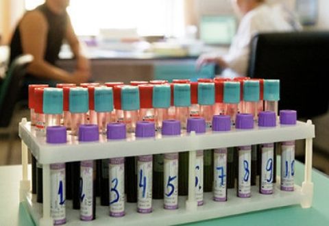 Легкая атлетика: четыре россиянки попались на допинге