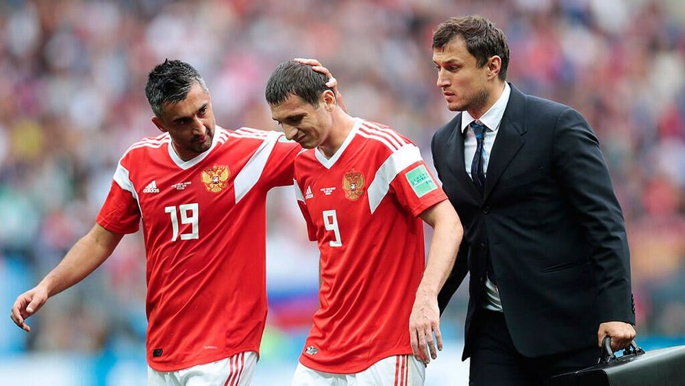 Сборная России перед Египтом: травмирован только Дзагоев