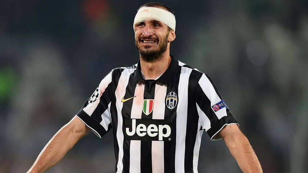 Кьеллини из-за травмы может пропустить первый матч четвертьфинала ЛЧ с «Реалом» Кьеллини из-за травмы может пропустить первый матч четвертьфинала ЛЧ с «Реалом»