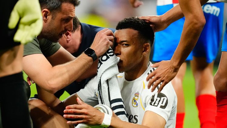 «Это пенальти даже на Луне». Фото окровавленного Мбаппе облетели весь мир