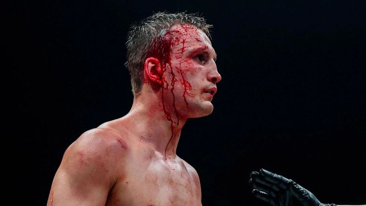 Чемпион мира Шумков назвал своим кумиром украинского боксера 